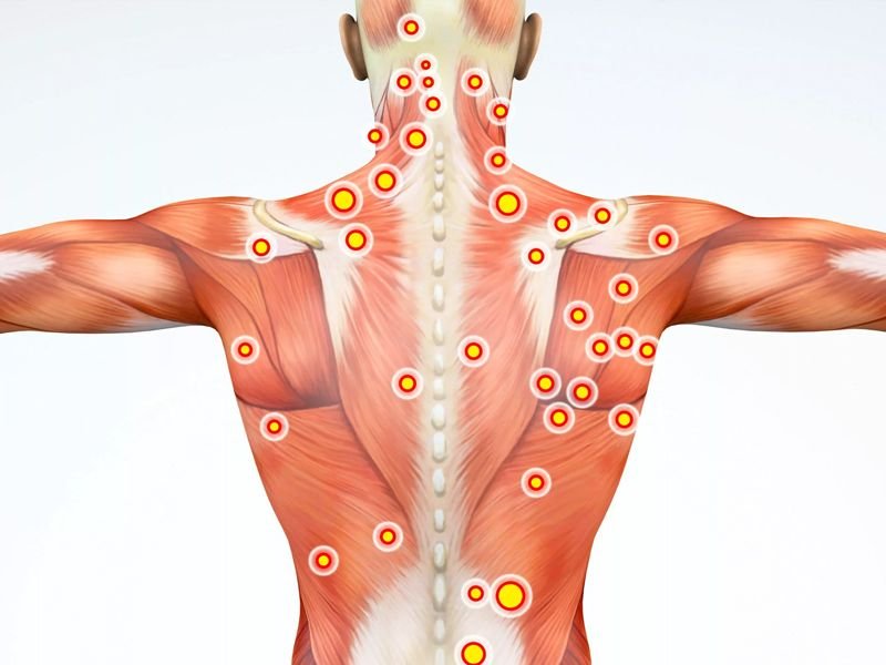 puntos gatillos dolorosos